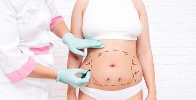 Abdominoplastia - Vista previa - Dr. Jorge Urenda