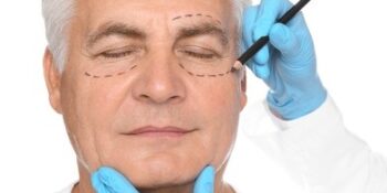 Blefaroplastia - Dr. Jorge Urenda - Hombres