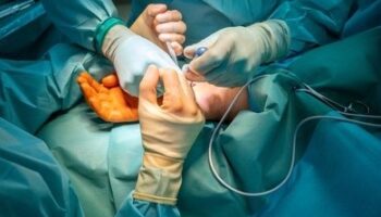 Cirugía de manos - Dr. Jorge Urenda