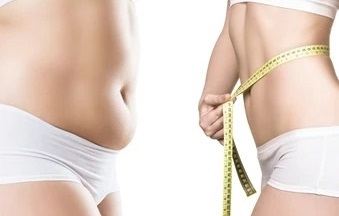 Liposucción - Vista Lateral - Dr. Jorge Urenda
